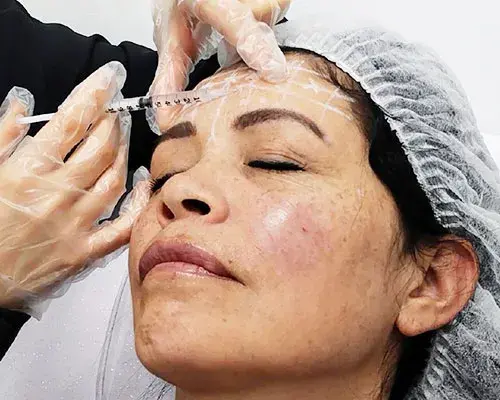 full face-bioestimulacion