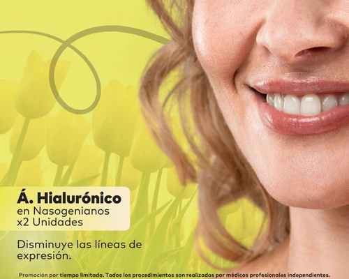 Ácido  Hialurónico </br> en Nasogenianos
