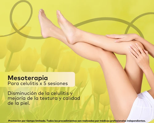 Mesoterapiapara celulitis
