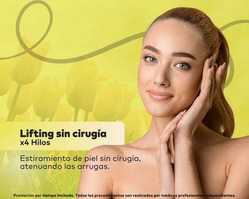 Lifting Sin Cirugía
