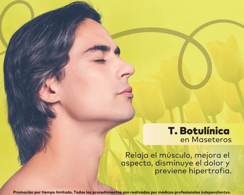 Toxina Botulínica en Maseteros