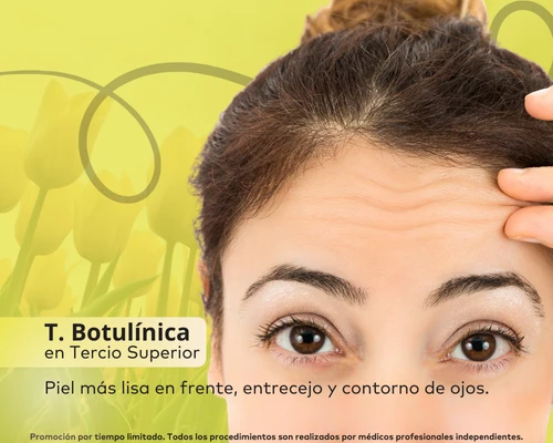 Toxina Botulínica </br> Tercio Superior