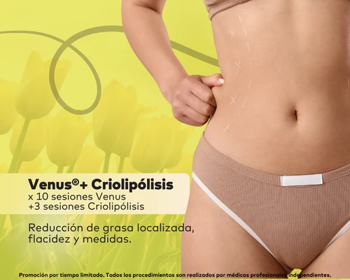 Venus® + Criolipólisis