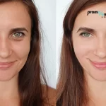 La IA en la estética: predicción de resultados